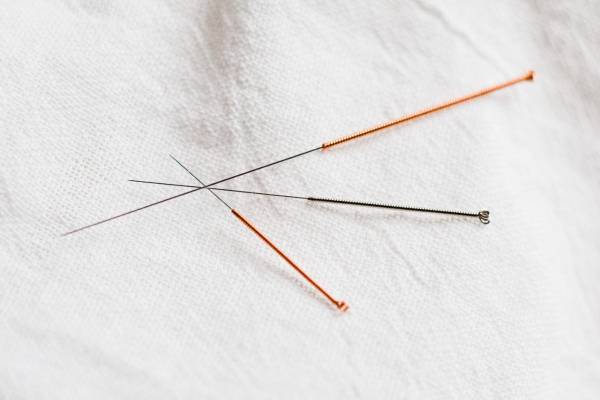 3 agulhas de acupuntura entre laçadas.